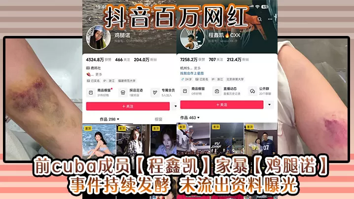 抖音百万网红 前cuba成员【程鑫凯】家暴【鸡腿诺】事件持续发酵 未流出资料曝光!